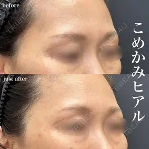 ルラ美容クリニック 名古屋栄院 / ルラスキンクリニック 名古屋栄院 関戸 優医師の症例
