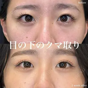 ルラ美容クリニック 名古屋栄院 / ルラスキンクリニック 名古屋栄院 関戸 優医師の症例