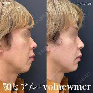 ルラ美容クリニック 名古屋栄院 / ルラスキンクリニック 名古屋栄院 関戸 優医師の症例