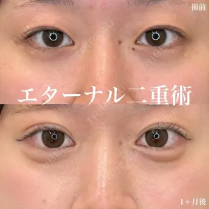 ルラ美容クリニック 名古屋栄院 / ルラスキンクリニック 名古屋栄院 関戸 優医師の症例