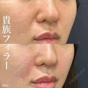 ルラ美容クリニック 名古屋栄院 / ルラスキンクリニック 名古屋栄院 関戸 優医師の症例