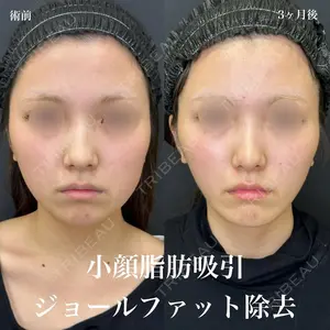 ルラ美容クリニック 名古屋栄院 / ルラスキンクリニック 名古屋栄院 関戸 優医師の症例