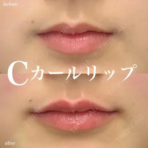ルラ美容クリニック 名古屋栄院 / ルラスキンクリニック 名古屋栄院 関戸 優医師の症例
