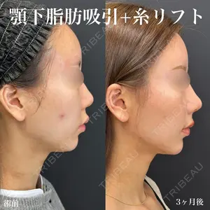 ルラ美容クリニック 名古屋栄院 / ルラスキンクリニック 名古屋栄院 関戸 優医師の症例