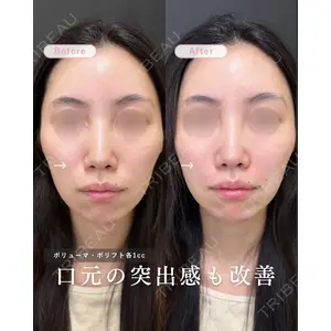 ルラ美容クリニック 名古屋栄院 / ルラスキンクリニック 名古屋栄院 関戸 優医師の症例