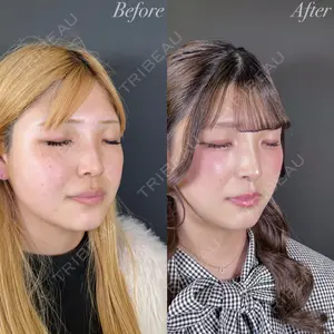 R Beauty CLINIC 大阪院 小池 泰弘医師の症例