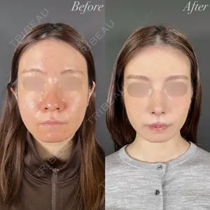 R Beauty CLINIC 大阪院 小池 泰弘医師の症例