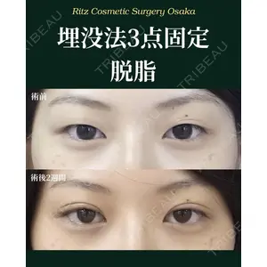 リッツ美容外科 大阪院 志賀　由章医師の症例