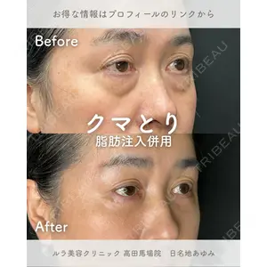 ルラ美容クリニック 高田馬場院 日名地 あゆみ医師の症例