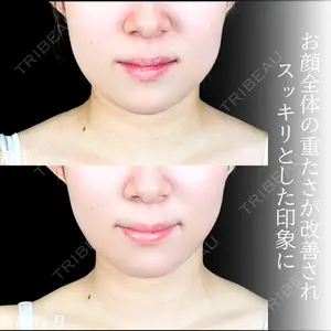 アリエル美容クリニック 大宮院 江郷隼一郎医師の症例