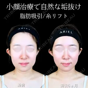 アリエル美容クリニック 大宮院 江郷隼一郎医師の症例