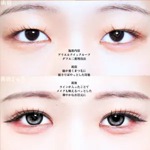 アリエル美容クリニック 大宮院 江郷隼一郎医師の症例