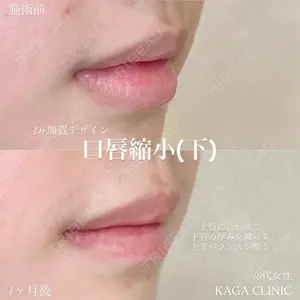 KAGA CLINICの症例