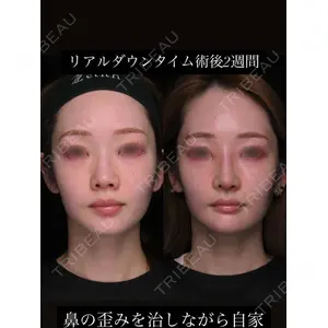 Zetith Beauty Clinic 銀座院 鉄 鑠医師の症例