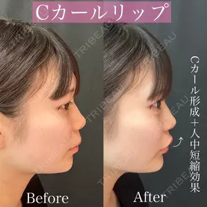 ルラ美容クリニック 渋谷本院 昼間 路子医師の症例