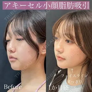 ルラ美容クリニック 渋谷本院 昼間 路子医師の症例