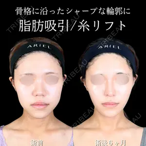 アリエル美容クリニック 大宮院 鈴木　桂介医師の症例