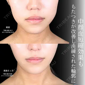 アリエル美容クリニック 大宮院 鈴木　桂介医師の症例