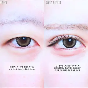 アリエル美容クリニック 水戸院 天白 典秀医師の症例