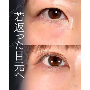 神戸美容外科 ネビュラクリニック 岩﨑 雅医師の症例