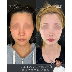 ルラ美容クリニック 渋谷本院 日下志 厳医師の症例