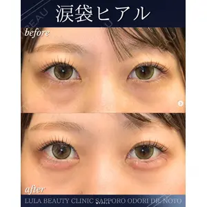 ルラ美容クリニック 札幌大通り院 能登 貴弘医師の症例