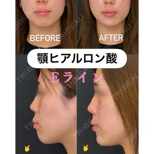 銀座美容クリニック 南草津院 廣瀨 昇吾医師の症例