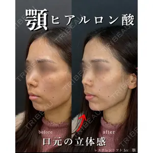 銀座美容クリニック 南草津院 廣瀨 昇吾医師の症例