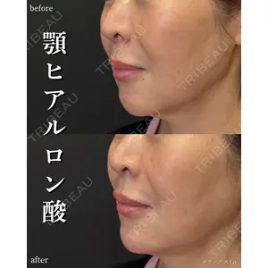 銀座美容クリニック 南草津院 廣瀨 昇吾医師の症例