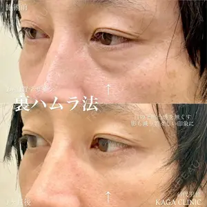 KAGA CLINICの症例