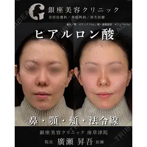 銀座美容クリニック 南草津院 廣瀨 昇吾医師の症例