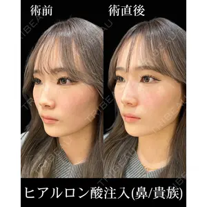 HAAB×DREAM BEAUTY CLINIC 東京本院 佐野 圭医師の症例