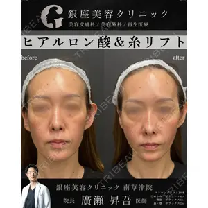 銀座美容クリニック 南草津院 廣瀨 昇吾医師の症例