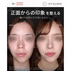 吉祥寺アイビークリニック 升本 浩紀医師の症例