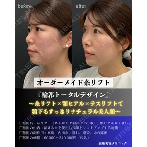 銀座美容クリニック 南草津院 廣瀨 昇吾医師の症例