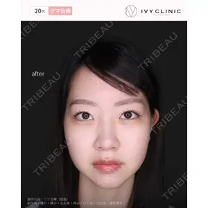 千葉美容外科アイビークリニックの症例