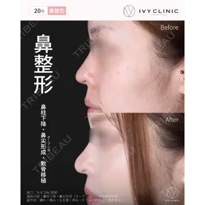 千葉美容外科アイビークリニックの症例