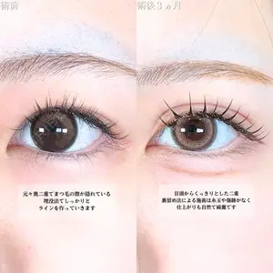 アリエル美容クリニック 大宮院 鈴木　桂介医師の症例