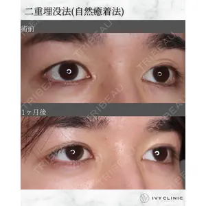 千葉美容外科アイビークリニックの症例