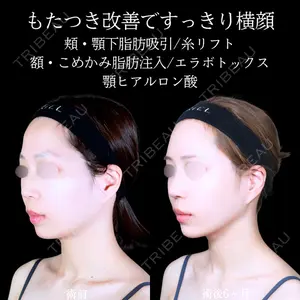 アリエル美容クリニック 郡山院 安齋 誠基医師の症例