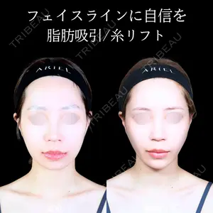 アリエル美容クリニック 郡山院 安齋 誠基医師の症例