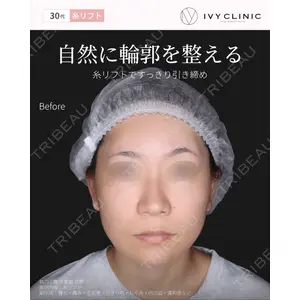千葉美容外科アイビークリニックの症例