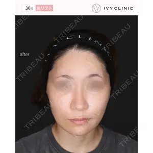 千葉美容外科アイビークリニックの症例