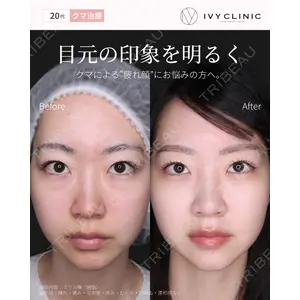 千葉美容外科アイビークリニックの症例