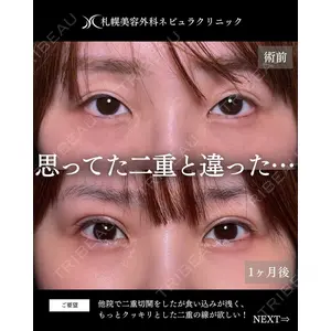 札幌美容外科ネビュラクリニック 横田 開医師の症例