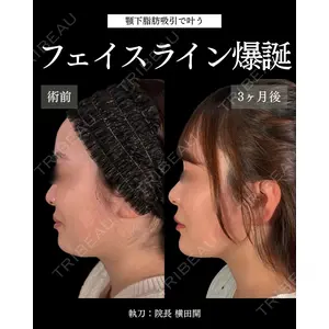 札幌美容外科ネビュラクリニック 横田 開医師の症例