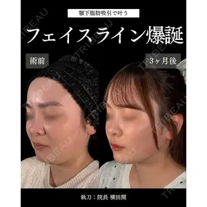 札幌美容外科ネビュラクリニック 横田 開医師の症例