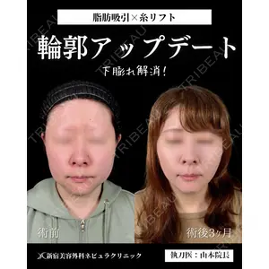 新宿美容外科ネビュラクリニック 山本 紘子医師の症例