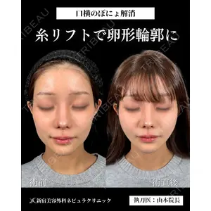 新宿美容外科ネビュラクリニック 山本 紘子医師の症例