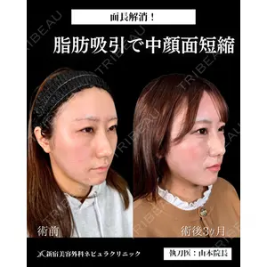新宿美容外科ネビュラクリニック 山本 紘子医師の症例